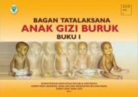 Image of Bagan Ttatalaksana Anak Gizi Buruk