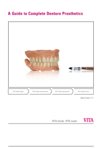 Image of A GUIDE TO COMPLETE DENTURE PRODTHETICS