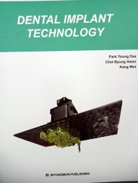 Image of Dental Implant Technology