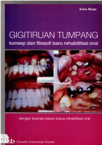 Image of Gigitiruan Tumpang : Konsep dan Filosofi Baru Rehabilitasi Oral