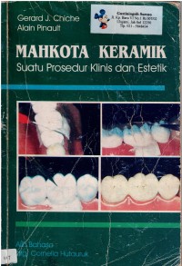 Image of Mahkota Keramik : Suatu Prosedur Klinis dan Estetik