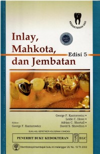 Image of Inlay, Mahkota, dan Jembatan