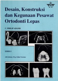 Image of Desain, Konstruksi dan Kegunaan Pesawat Ortodonti Lepas