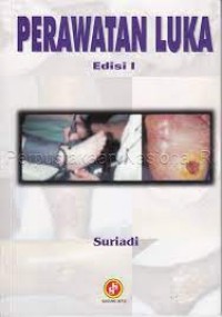 Image of Perawatan Luka
