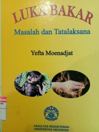 Image of Luka Bakar : Masalah dan Tatalaksana
